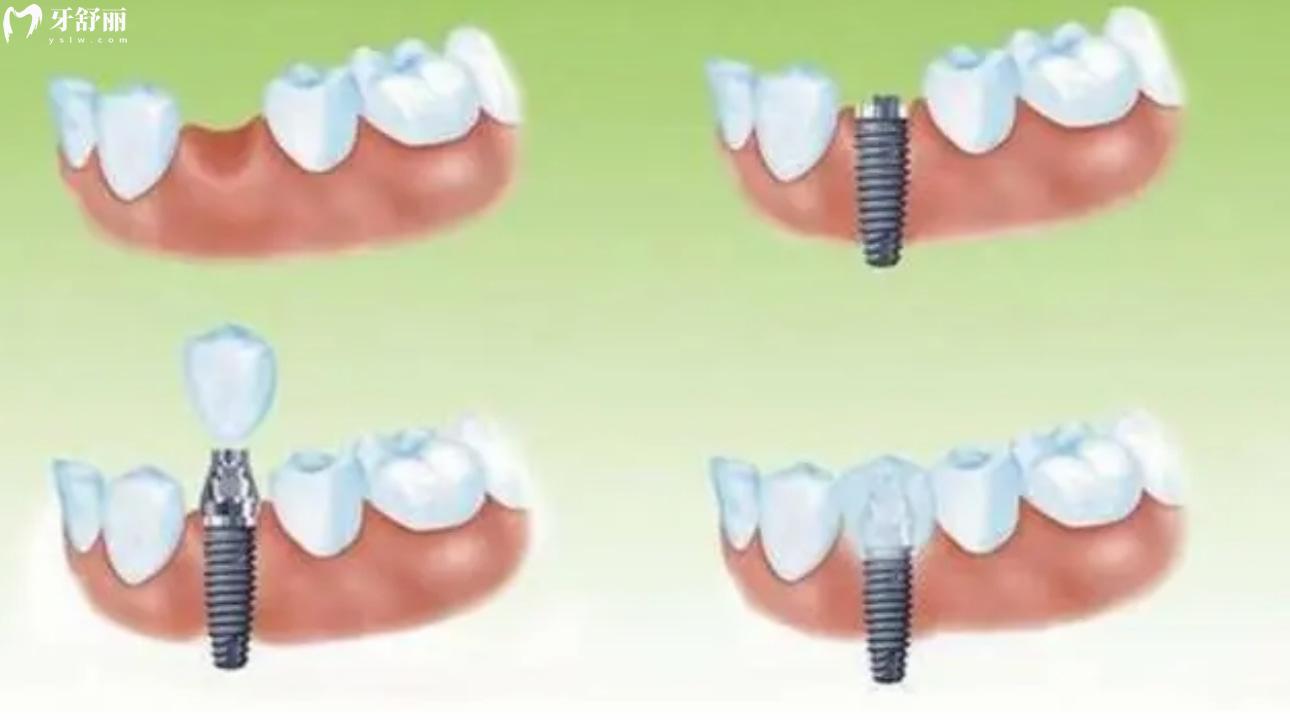 山東煙臺(tái)壹顆芽口腔門(mén)診部