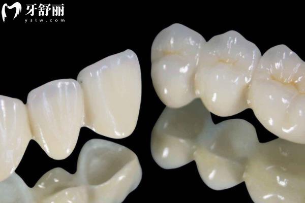 宜春牙科收費價格標準--鑲牙