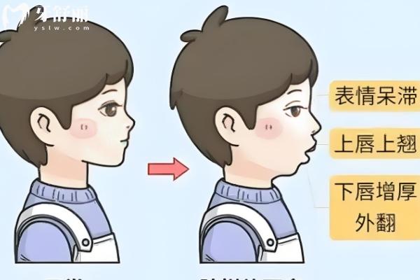 懷化牙齒矯正大概要花費(fèi)多少錢(qián)