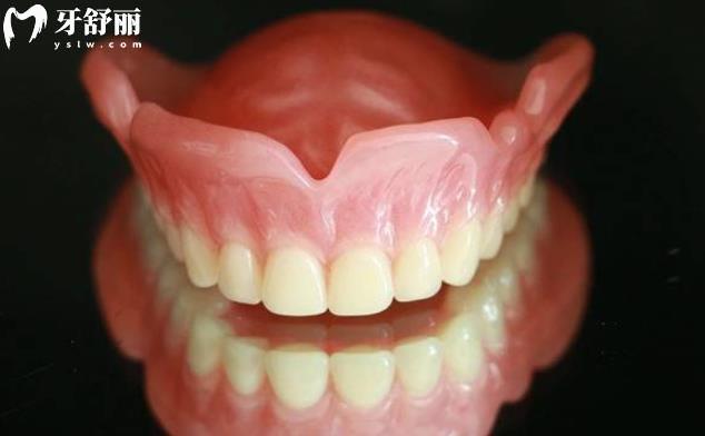 解析吸附性義齒的優(yōu)缺點(diǎn),和普通義齒有啥差別及價格