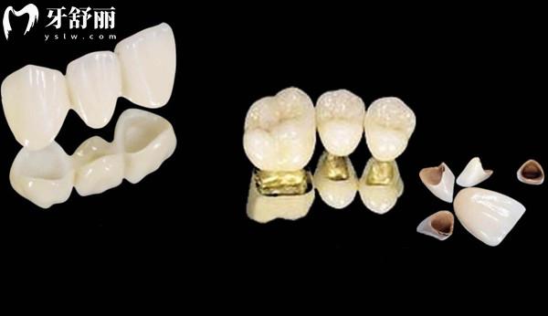福州登特口腔2025價(jià)目表下調(diào)(種植牙/正畸/牙冠/補(bǔ)牙/拔牙收費(fèi)標(biāo)準(zhǔn)明細(xì)一覽)