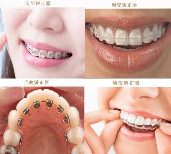 宜春拜博口腔醫(yī)院2026收費(fèi)標(biāo)準(zhǔn):洗牙80元起