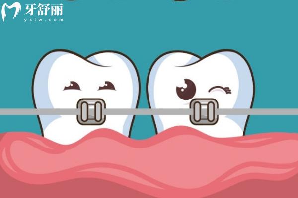 洛陽拔牙多少錢一顆