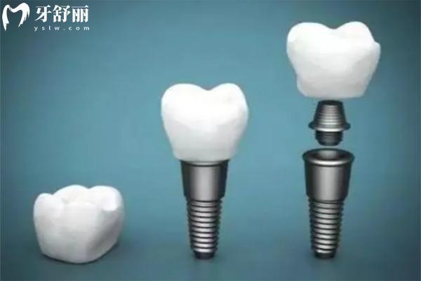 廊坊十大口腔醫(yī)院排名