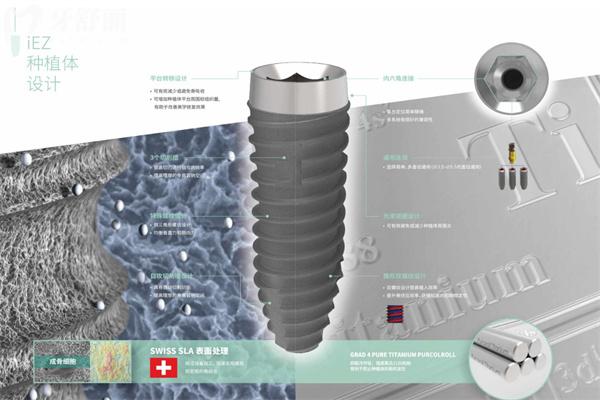 種植牙選國產(chǎn)的還是進口的好?對比種植牙品牌材質(zhì)/使用性能/價格標準等可知