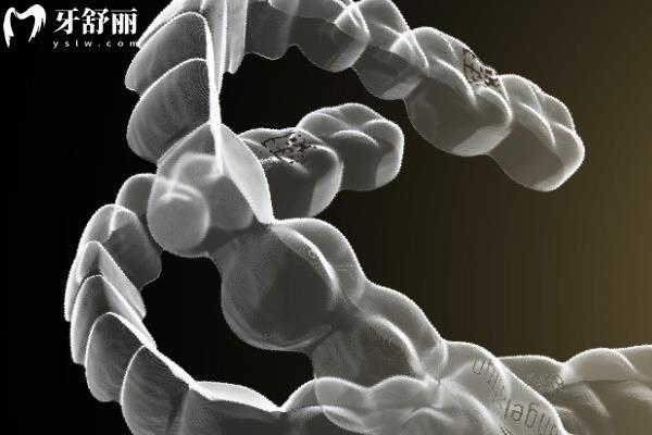 時(shí)代天使隱形矯正有哪些系列