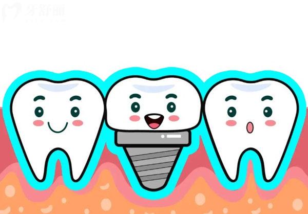 瑞典尼奧斯種植牙是雜牌子嗎?不是,深度解析品牌實(shí)力/技術(shù)優(yōu)勢(shì)/價(jià)格