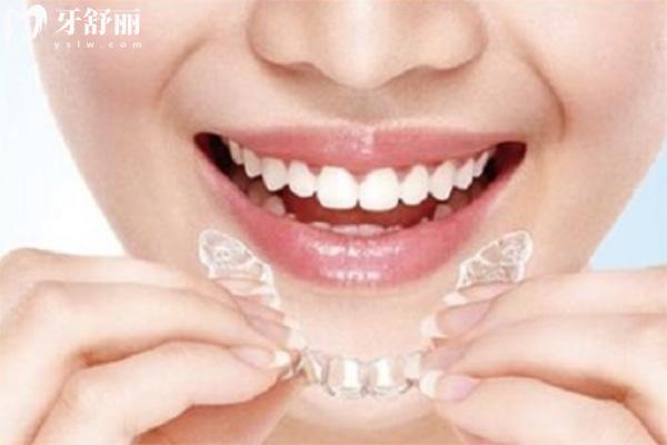 濟(jì)南做種植牙的醫(yī)院哪家好