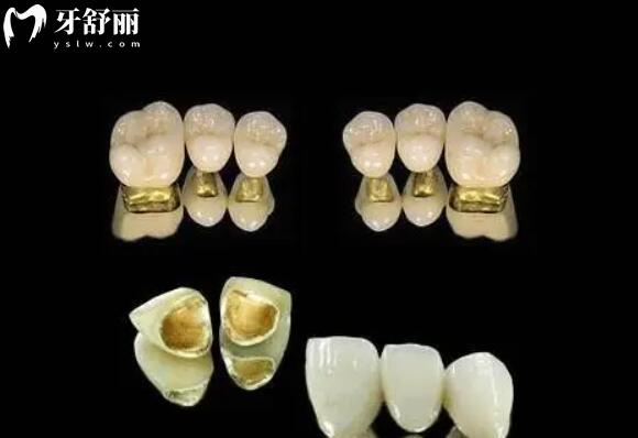 2026超全佛山莞口口腔醫(yī)院收費(fèi)標(biāo)準(zhǔn):種牙