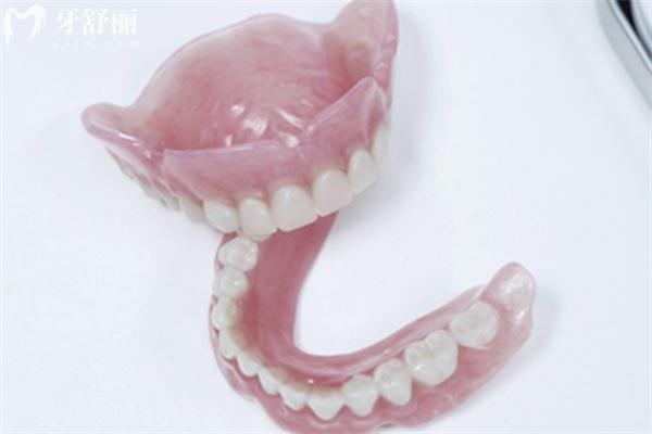 裝一口假牙能維持多久?盤點裝假牙不同方法及材質(zhì)區(qū)別對假牙使用年限的影響