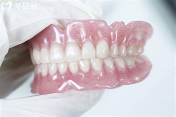 裝一口假牙能維持多久?盤點裝假牙不同方法及材質(zhì)區(qū)別對假牙使用年限的影響