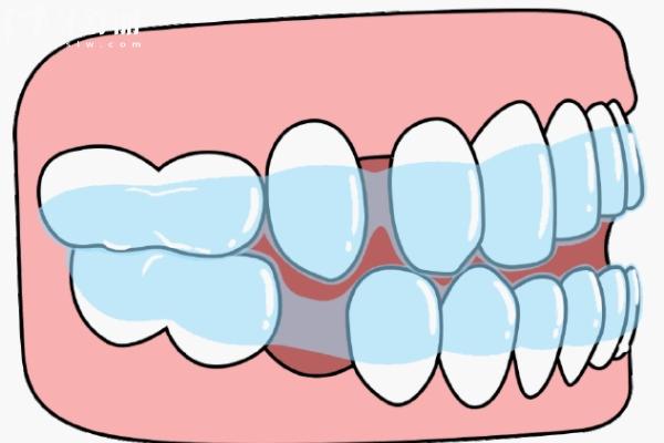 北京笑研口腔價格表