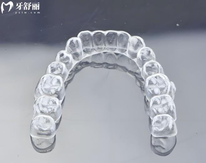 時代天使和隱適美區(qū)別大嗎?深度對比:從材質技術到價格的差異