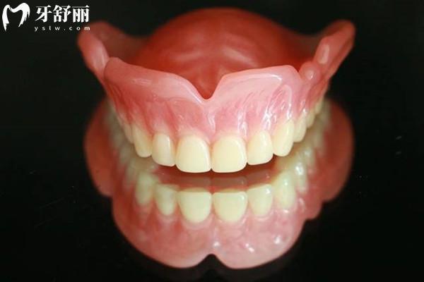 16000元一口吸附性義齒貴嗎？