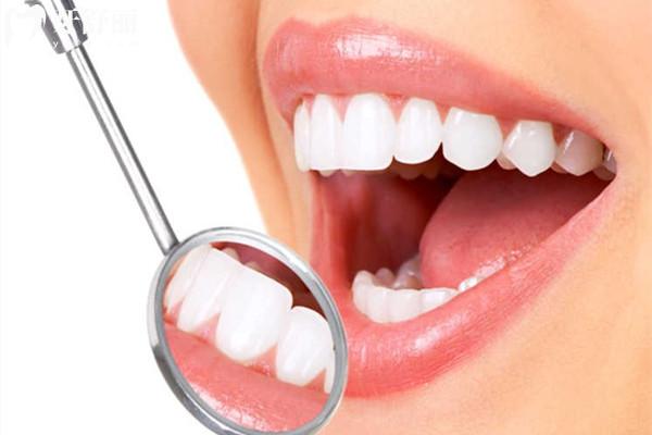 牙齦切除術(shù)收費(fèi)標(biāo)準(zhǔn)