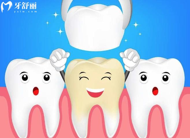 揭曉美國(guó)拉瓦全瓷牙怎么樣？一般多少錢(qián)？