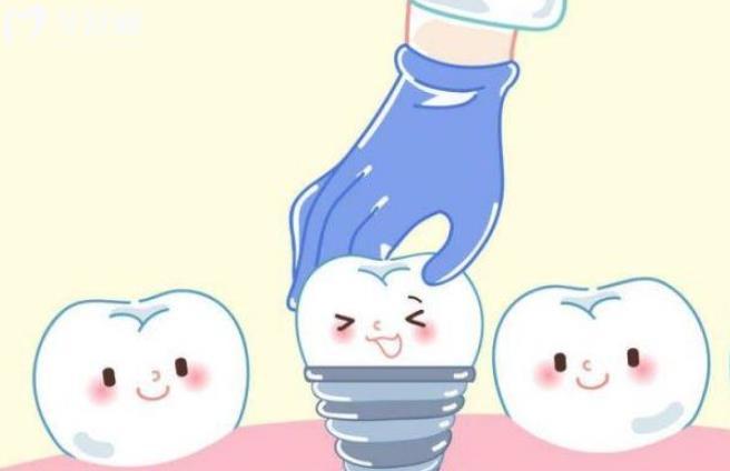 60歲老人掉牙是什么原因?應(yīng)該怎么處理,是種植牙還是鑲牙