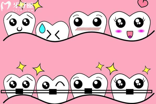 安順種植牙哪家好