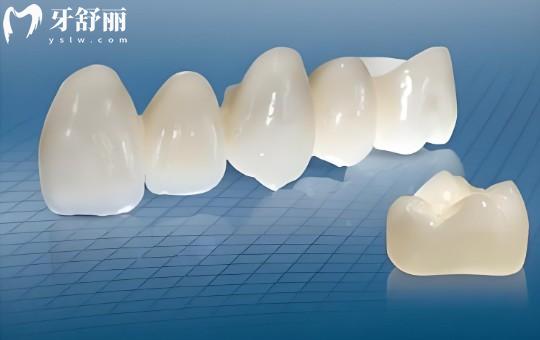 【2026珠海牙科收費標準全指南】從種植牙到兒牙治療9大項目價目表深度解析