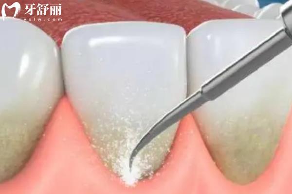 焦作靠譜牙科排名