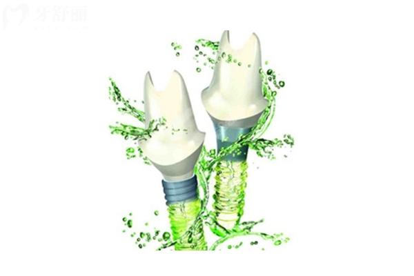 常州佧瓦口腔種植牙怎么樣？資質(zhì) / 價格 / 優(yōu)勢 / 醫(yī)生全攻略