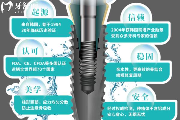 韓國科威爾種植牙怎么樣