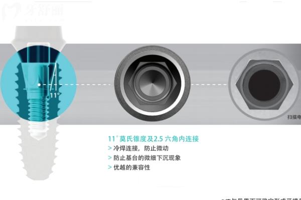 韓國科威爾種植牙怎么樣