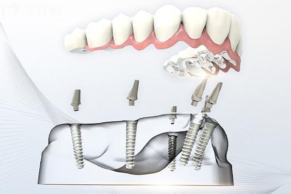 上海摩爾口腔有二十多家