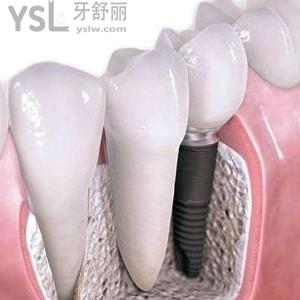 廣東金屬托槽矯正價格多少？珠海九龍口腔價格優(yōu)惠大揭秘