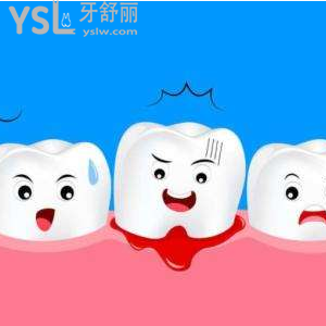 牙周炎和牙齦炎一樣嗎 怎么區(qū)別？