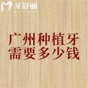 廣州補(bǔ)貼后種植牙需要多少錢？2025年廣州種植牙（單顆/半口/全口）價(jià)格已下調(diào)