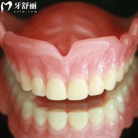 解析吸附性義齒的優(yōu)缺點(diǎn),和普通義齒有啥差別及價(jià)格