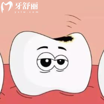 嘴巴里4顆蛀牙怎么辦？來看看如何治療比較好