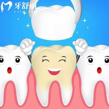 揭曉美國拉瓦全瓷牙怎么樣？一般多少錢？