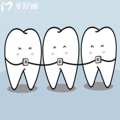 上海看牙去哪好?這幾家口腔醫(yī)院口碑爆棚,上海市民說技術(shù)好,趕緊收藏！